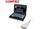CMS600P2 Sistema Diagnostico Ad Ultrasuoni B Portatile Da 10,1 Pollici Ecografo Digitale Dispositivo Ad Ultrasuoni Con Sonda Convessa Da 3,5 Mhz