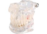Modello Dentale Denti Mascellari Impianti Dentali