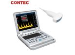 Dispositivo Ecografico Doppler A Colori Portatile Da 15 Pollici Sistema Diagnostico Portatile Sonda Convessa