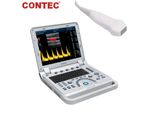 Dispositivo Diagnostico A Ultrasuoni Color Doppler Con Sonda Phased Array Ad Alta Risoluzione Cardiologia Dispositivo Portatile Per Laptop