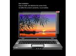 Protezione Dello Schermo, Pellicola Protettiva Dello Schermo, Vetro Temperato, Protezione Dello Schermo In Vetro Temperato, Protezione Dello Schermo Per Huawei, Vetro Temperato Per Laptop, Protezione Dello Schermo Per Lenovo, Protezione Dello Schermo Per Dell