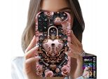 Custodia Per Xiaomi Note 11 Pro - Femminile, Modelli Di Moda, Lucchetto Cuore Rosa