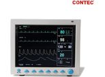 CMS8000 Monitor Paziente Veterinario, Segni Vitali, Multiparametro, Capnografo Vet, Ecg, Nibp, SPO2, Resp, Temp, Pr, ETCO2 Per Cani, Gatti, Cavalli, Mucche, Pecore