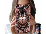 Custodia Per Xiaomi Note 8 Pro - Femminile, Modelli Di Moda, Lucchetto Cuore Rosa