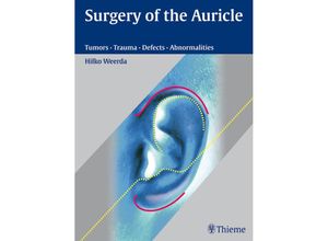 Surgery of the Auricle - Hilko Weerda, Gebunden