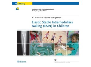 Elastic Stable Intramedullary Nailing (ESIN) in Children - Peter Illing, Pierre Lascombes, Gebunden