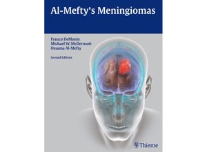 Al-Mefty's Meningiomas - Franco DeMonte, Michael W. McDermott, Ossama Al-Mefty, Gebunden