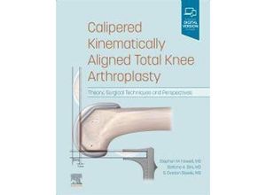 Calipered Kinematically aligned Total Knee Arthroplasty - Stephen M. Howell, Stefano A. Bini, G. Daxton Steele, Gebunden