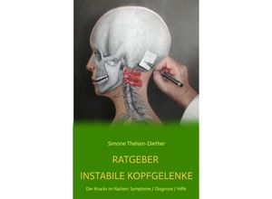 Ratgeber Instabile Kopfgelenke - Simone Theisen-Diether, Kartoniert (TB)