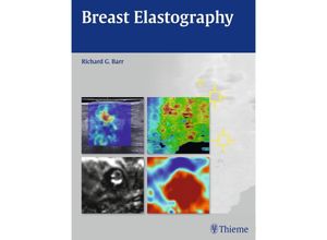 Breast Elastography - Richard G. Barr, Gebunden