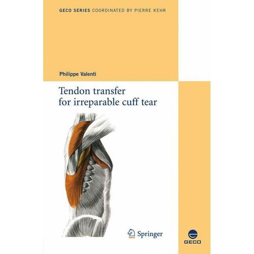 Collection GECO / Tendon transfer for irreparable cuff tear, Kartoniert (TB)