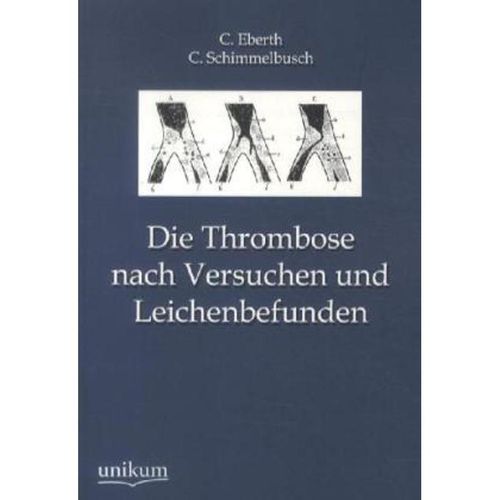 Die Thrombose nach Versuchen und Leichenbefunden - C. Eberth, C. Schimmelbusch, Kartoniert (TB)