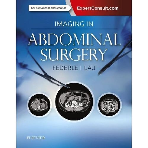 Imaging in Abdominal Surgery - Michael P Federle, James Lau, Gebunden