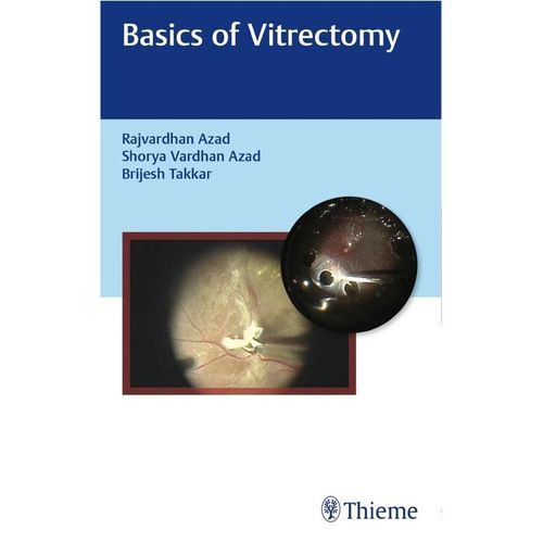 Basics of Vitrectomy, Gebunden
