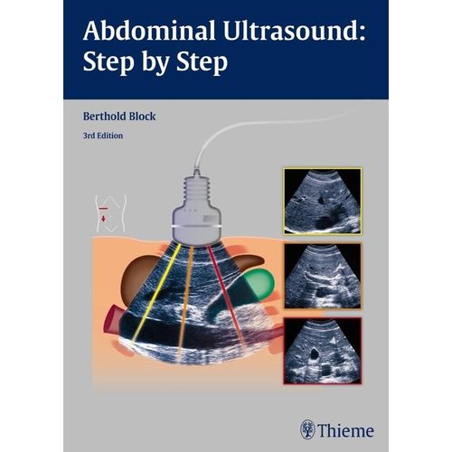 Abdominal Ultrasound: Step by Step - Berthold Block, Kartoniert (TB)