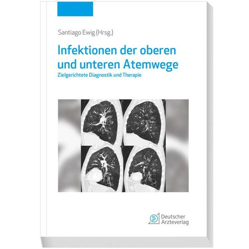 Infektionen der oberen und unteren Atemwege - Santiago Ewig, Kartoniert (TB)