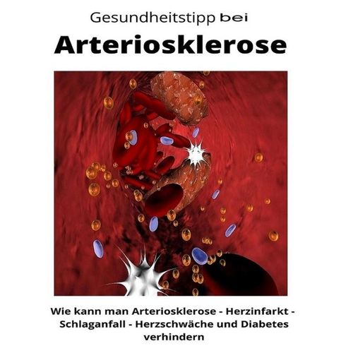 Gesundheitstipp bei Arteriosklerose - Maximilian Loidl, Kartoniert (TB)