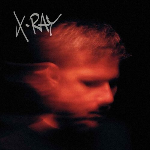 X-Ray (2lp) (Vinyl) - Murdock. (LP)