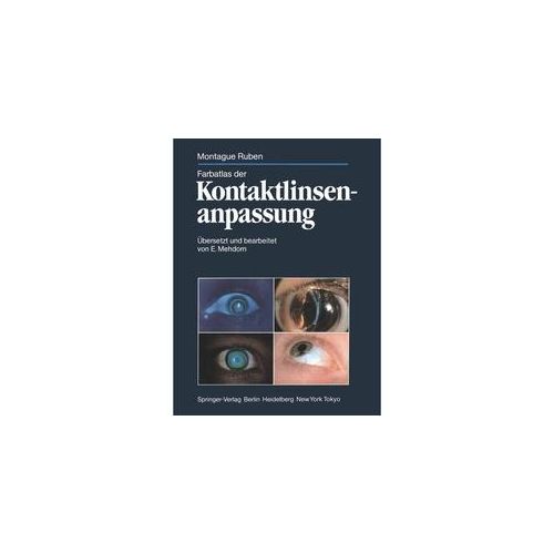 Farbatlas Der Kontaktlinsenanpassung - Montague Ruben Kartoniert (TB)