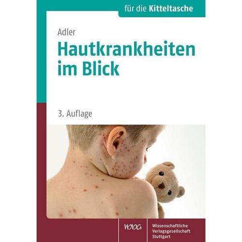 Hautkrankheiten im Blick - Yael Adler, Kartoniert (TB)