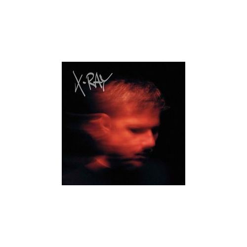 X-Ray (2lp) (Vinyl) - Murdock. (LP)
