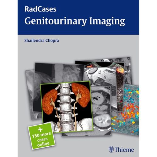 Radcases Genitourinary Imaging - Shailendra Chopra, Kartoniert (TB)