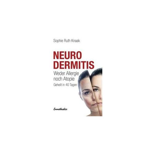 Neurodermitis