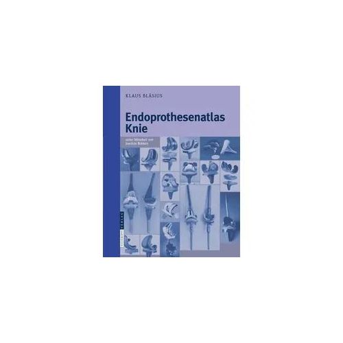 Endoprothesenatlas Knie
