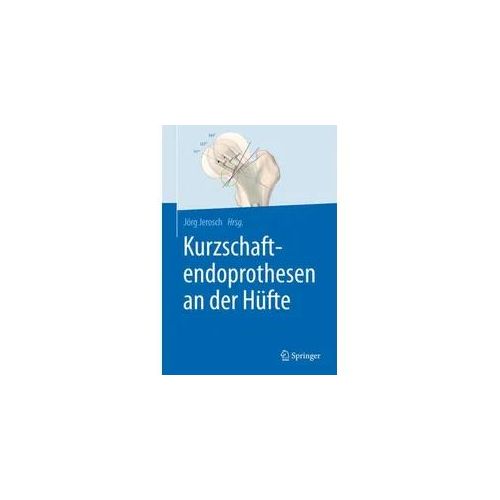 Kurzschaftendoprothesen an der Hüfte