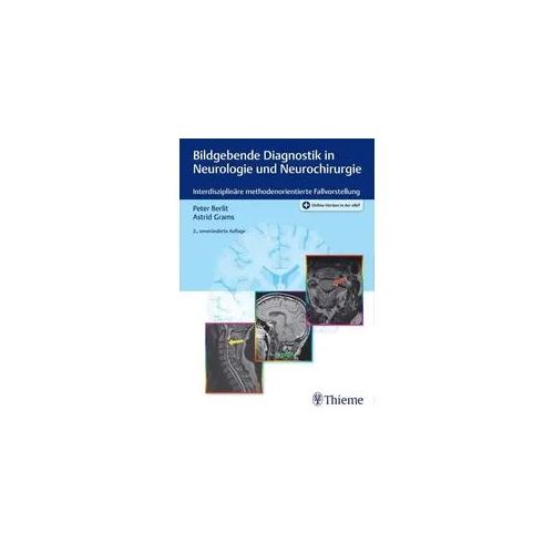 Bildgebende Diagnostik in Neurologie und Neurochirurgie