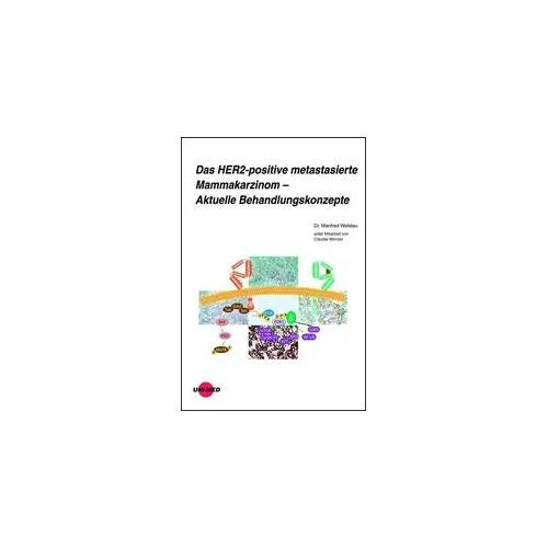 Das HER2-positive metastasierte Mammakarzinom – Aktuelle Behandlungskonzepte