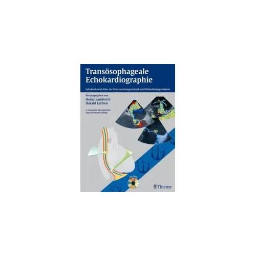 Transösophageale Echokardiographie