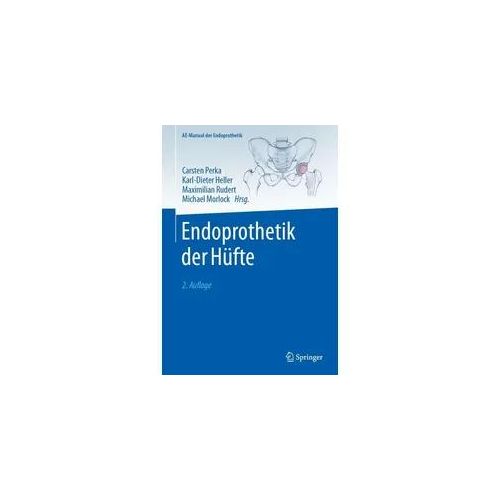 Endoprothetik der Hüfte