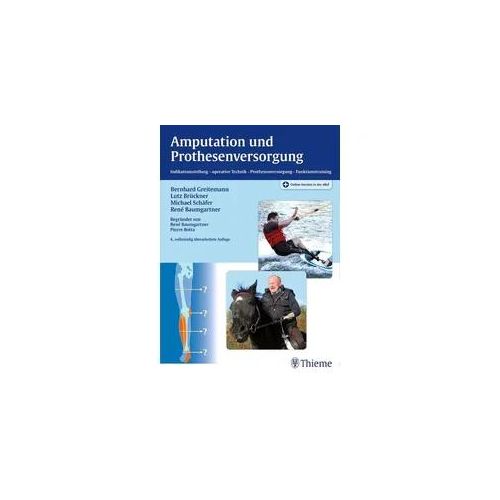 Amputation und Prothesenversorgung