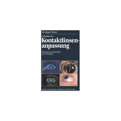 Farbatlas der Kontaktlinsenanpassung