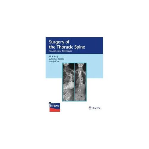 Surgery of the Thoracic Spine