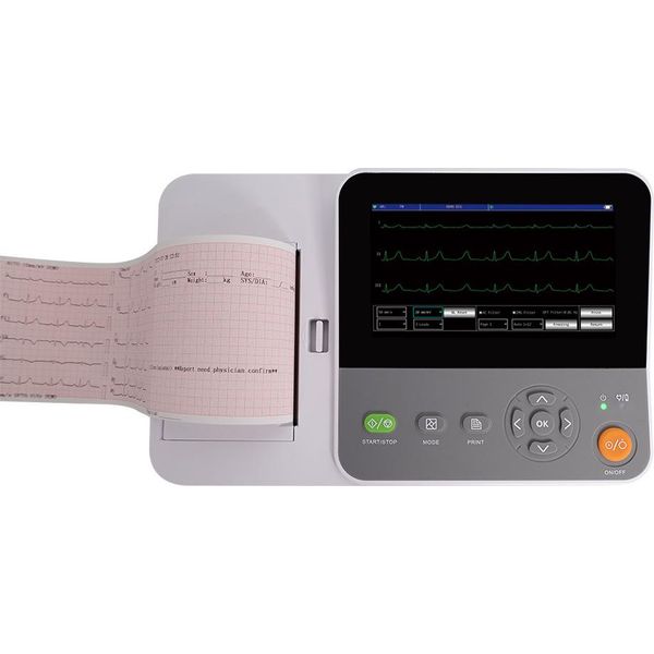 E6 Macchina Ecg Portatile A 12 Derivazioni Elettrocardiografo Con Stampante 6 Canali 7" Touchscreen Softkey Pc Software Interpretazione Macchina Ecg A 12 Derivazioni A 6 Canali"-image