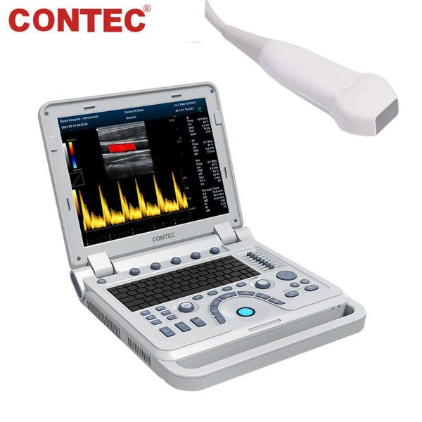Dispositivo Diagnostico A Ultrasuoni Color Doppler Con Sonda Phased Array Ad Alta Risoluzione Cardiologia Dispositivo Portatile Per Laptop-image