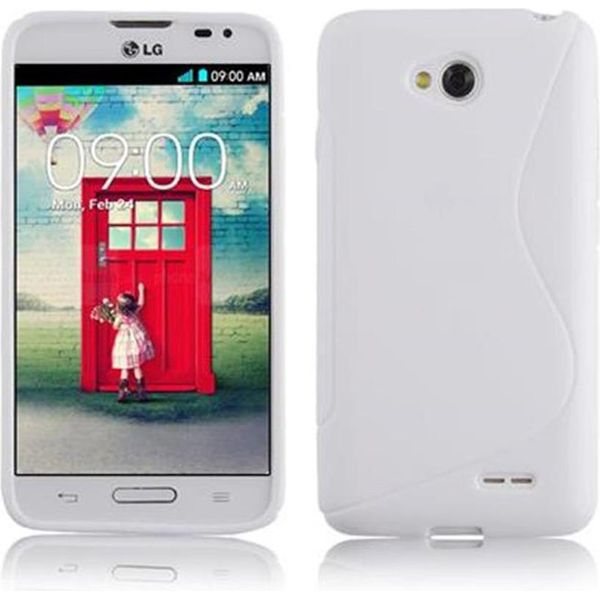 Cadorabo Cover Protettiva Per Lg L70 (1A Sim) Cover In Bianco Custodia Per Cellulare Tpu Custodia In Silicone-image