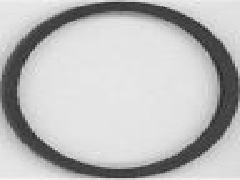 Anello Di Tenuta